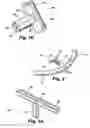 Fig. 03 - Shunt device and method for treating ocular disorders