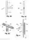 Fig. 04 - Shunt device and method for treating ocular disorders
