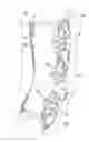Fig. 02 - COMPRESSION THERAPY APPARATUS, SYSTEMS, AND METHODS