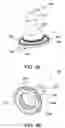 Fig. 06 - Bubble formation inhibiting vent assembly for a vented bottle assembly