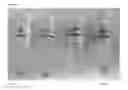 Fig. 10 - METHODS OF TREATMENT AND PHARMACEUTICAL COMPOSITIONS USING BCN057 OR BCN512