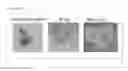 Fig. 14 - METHODS OF TREATMENT AND PHARMACEUTICAL COMPOSITIONS USING BCN057 OR BCN512