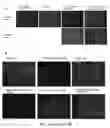 Fig. 04 - VIABLE LYOPHILIZED COMPOSITIONS DERIVED FROM HUMAN TISSUES AND METHODS OF MAKING THE SAME
