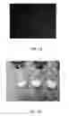 Fig. 14 - VIABLE LYOPHILIZED COMPOSITIONS DERIVED FROM HUMAN TISSUES AND METHODS OF MAKING THE SAME