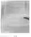 Fig. 17 - VIABLE LYOPHILIZED COMPOSITIONS DERIVED FROM HUMAN TISSUES AND METHODS OF MAKING THE SAME
