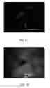 Fig. 22 - VIABLE LYOPHILIZED COMPOSITIONS DERIVED FROM HUMAN TISSUES AND METHODS OF MAKING THE SAME