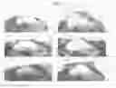 Fig. 06 - Female menopause alleviation use of composition containing composite extract of red clover and pomegranate as active ingredient