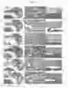 Fig. 16 - Female menopause alleviation use of composition containing composite extract of red clover and pomegranate as active ingredient