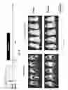 Fig. 48 - CD5 chimeric antigen receptor for adoptive T cell therapy