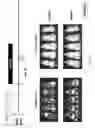 Fig. 49 - CD5 chimeric antigen receptor for adoptive T cell therapy