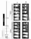 Fig. 50 - CD5 chimeric antigen receptor for adoptive T cell therapy