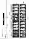 Fig. 52 - CD5 chimeric antigen receptor for adoptive T cell therapy