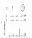 Fig. 07 - METHODS AND PHARMACEUTICAL COMPOSITIONS FOR TREATING CELIAC DISEASE AND GLUTEN INTOLERANCE
