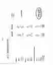 Fig. 09 - METHODS AND PHARMACEUTICAL COMPOSITIONS FOR TREATING CELIAC DISEASE AND GLUTEN INTOLERANCE