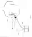 Fig. 02 - Devices and methods for managing chest drainage