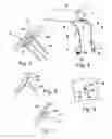 Fig. 02 - Implantable blood conveying device, manipulating device and coupling device