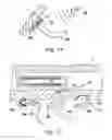 Fig. 04 - Implantable blood conveying device, manipulating device and coupling device