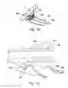 Fig. 05 - Implantable blood conveying device, manipulating device and coupling device
