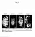 Fig. 02 - Methods for therapeutic targeting of circulating tumor cells during hemodialysis