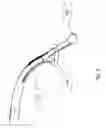 Fig. 07 - Device for facilitating the administration of a medicament to the lung by a catheter