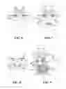 Fig. 04 - Breathing biofeedback eyeglasses