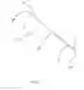 Fig. 03 - Dual lumen microcatheter