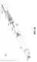 Fig. 08 - Catheter-based system for delivery and retrieval of a leadless pacemaker