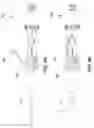 Fig. 20 - Catheter-based system for delivery and retrieval of a leadless pacemaker