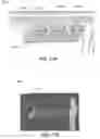 Fig. 29 - Catheter-based system for delivery and retrieval of a leadless pacemaker