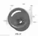 Fig. 47 - Catheter-based system for delivery and retrieval of a leadless pacemaker