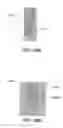 Fig. 57 - Catheter-based system for delivery and retrieval of a leadless pacemaker
