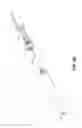 Fig. 08 - Catheter-based system for delivery and retrieval of a leadless pacemaker