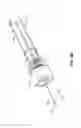 Fig. 09 - Catheter-based system for delivery and retrieval of a leadless pacemaker