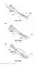 Fig. 35 - Catheter-based system for delivery and retrieval of a leadless pacemaker