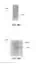 Fig. 57 - Catheter-based system for delivery and retrieval of a leadless pacemaker