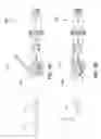 Fig. 20 - Catheter-based system for delivery and retrieval of a leadless pacemaker