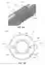 Fig. 30 - Catheter-based system for delivery and retrieval of a leadless pacemaker