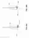 Fig. 37 - Catheter-based system for delivery and retrieval of a leadless pacemaker