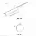 Fig. 07 - Catheter-based system for delivery and retrieval of a leadless pacemaker