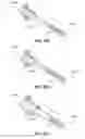 Fig. 35 - Catheter-based system for delivery and retrieval of a leadless pacemaker