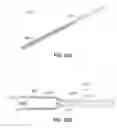 Fig. 53 - Catheter-based system for delivery and retrieval of a leadless pacemaker