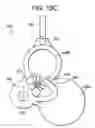 Fig. 20 - Shunt flushers and related methods