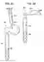Fig. 24 - Shunt flushers and related methods