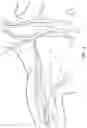 Fig. 04 - Subcutaneous vascular access assemblies and related devices and methods