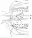 Fig. 05 - Subcutaneous vascular access assemblies and related devices and methods