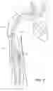 Fig. 09 - Subcutaneous vascular access assemblies and related devices and methods
