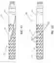 Fig. 12 - Subcutaneous vascular access assemblies and related devices and methods