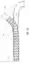 Fig. 13 - Subcutaneous vascular access assemblies and related devices and methods