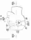 Fig. 14 - Securing an implanted medical device in a patient