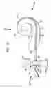 Fig. 16 - Securing an implanted medical device in a patient
